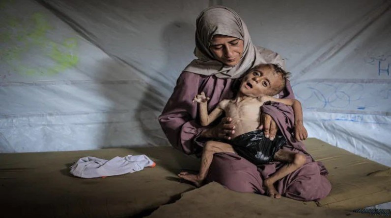 صحة غزة: وفاة 4 أشخاص جوعا خلال ساعات.. وإجلاء المصابين يقتلهم