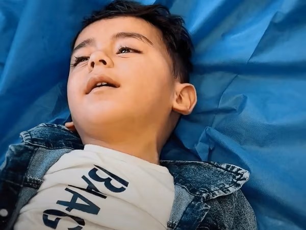في قلب الانهيار.. عملية دقيقة في غزة تنقذ طفلاً من إعاقة مدى الحياة
